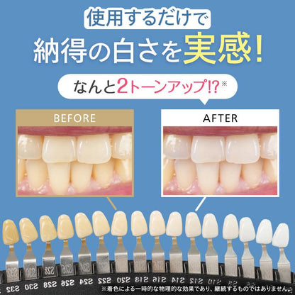 LUMIKA V CRYSTAL｜黄ばみ・着色汚れを落として白い歯へ導くホワイトニング歯磨きジェル